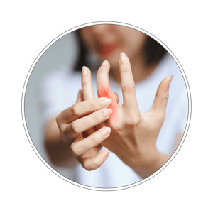 Pakiet badań Reumatologiczny pełny