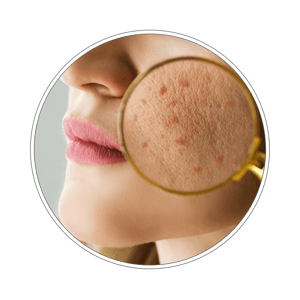 Pakiet badań zdrowa skóra