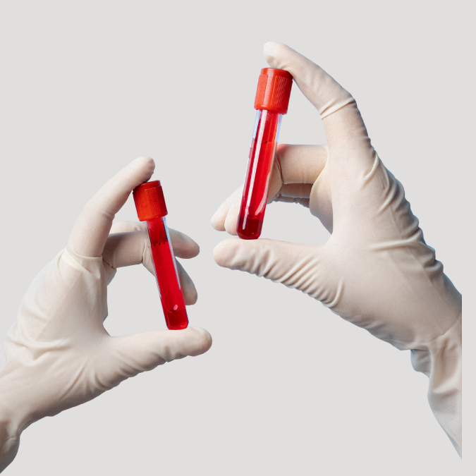 Ferrytyna – najważniejszy wskaźnik zapasów żelaza.