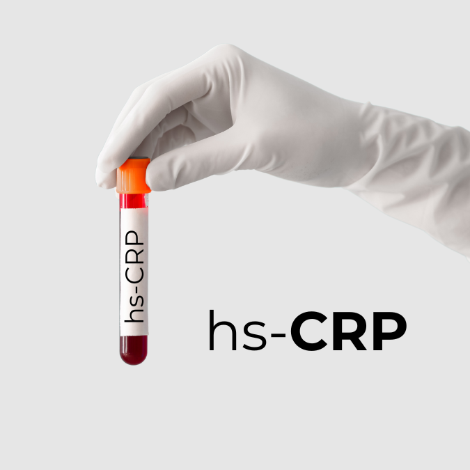 Badanie hs-CRP – czym jest i jakie ma znaczenie diagnostyczne?
