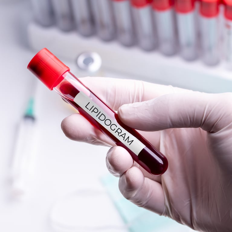 Lipidogram – co to za badanie i dlaczego warto kontrolować cholesterol?